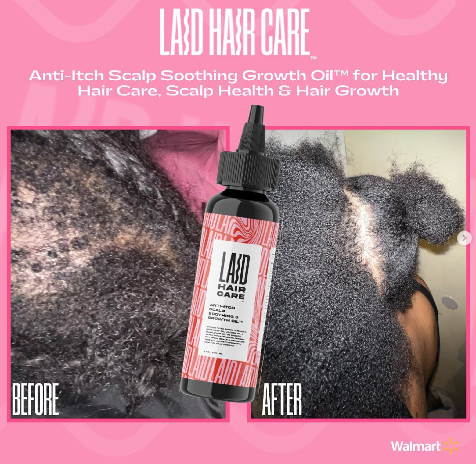 LAID Hair Care Weightless Collection For Healthy Hair Growth - Scalp & Hair Health System